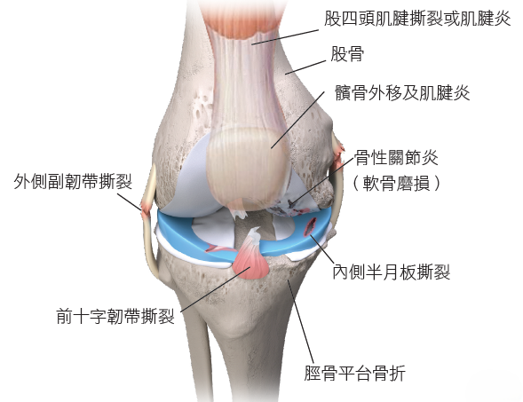 膝部結構與傷患